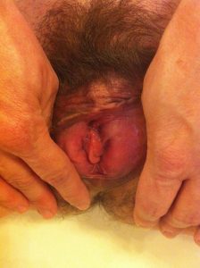 femme chaude dans le 92 avec chatte poilue